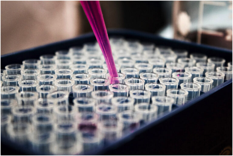 Ways You Can Support Lewy Body Dementia Research